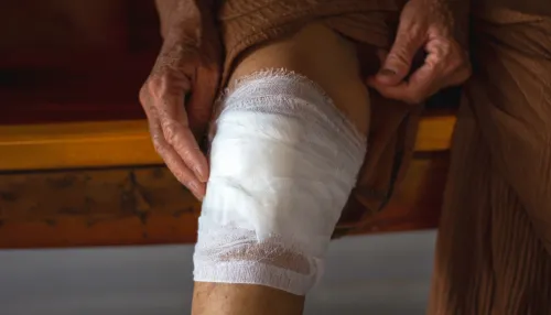 Bild eines verbundenen Knies einer älteren Person